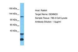 DENND3 Rabbit anti-Human, Polyclonal, Novus Biologicals 0.1 mL | Buy Online | Novus Biologicals | Fisher Scientific